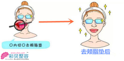 术后效果