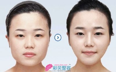 案例对比