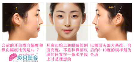 理想的耳部形态示意图