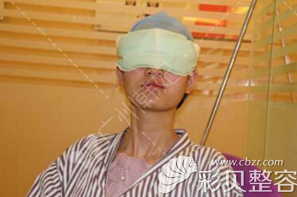 找广州韩妃于洪瑞做双眼皮手术后进行冰敷眼睛