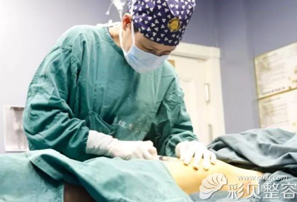 梁耀婵医生做腰腹部吸脂手术中