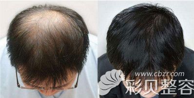 韩妃赵进植发案例效果图