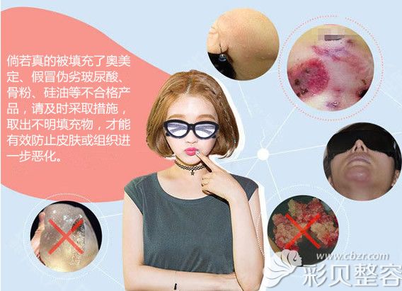 奥美定隆鼻何时流行的荔医邓正军告知取出奥美定刻不容缓