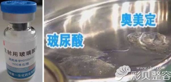 玻尿酸分子量很小奥美定颗粒偏大