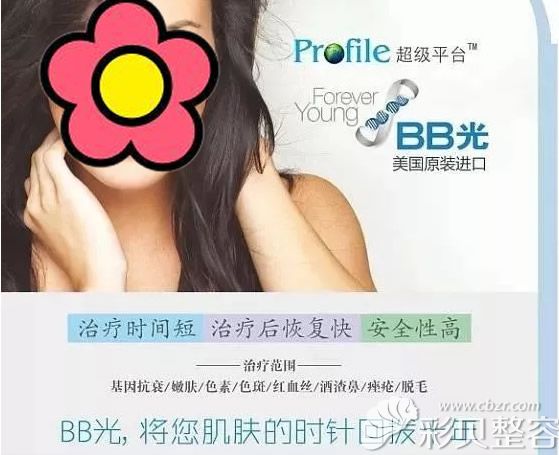 Profile超级平台BBL激光仪作用