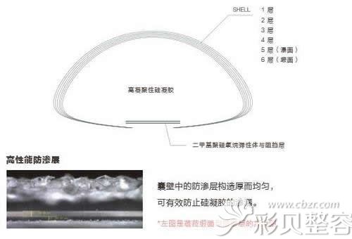 韩国蓓拉隆胸假体优点介绍