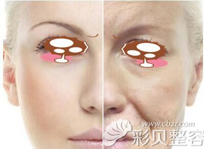 鼻子会因为年龄变塌变大?韩国艾恩整形告诉你鼻子衰老迹象
