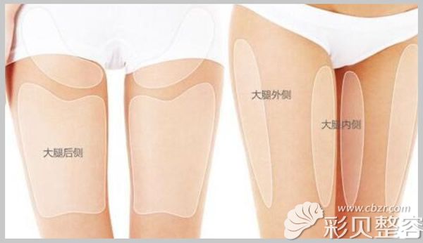 大腿吸脂部位图解