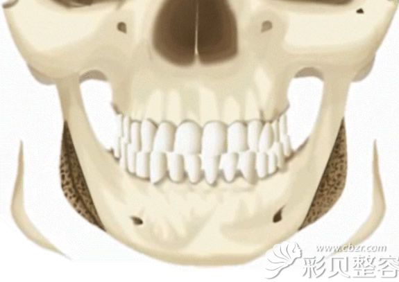 上海时光何晋龙下颌骨3D缩小图解