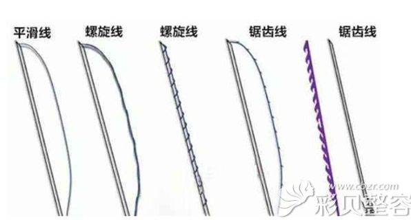 PPDO平滑线、螺旋线、锯齿线形状