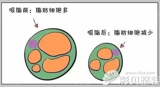 吸脂前后细胞数量变化图