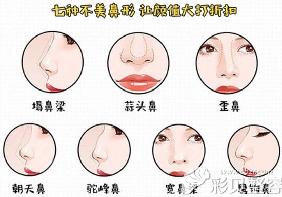 七种不美的鼻型