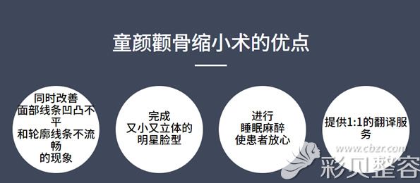 韩国ID医院童颜颧骨缩小术优势