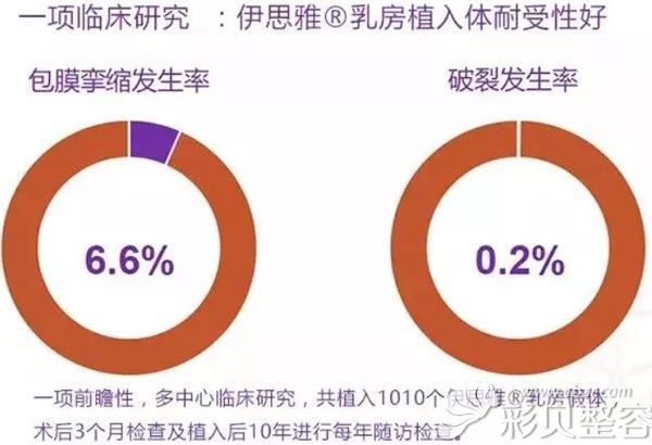 法国伊斯雅假体材料的临床研究
