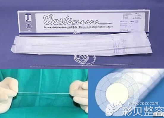 意大利elasticum硅胶弹力线形状 意大利elasticum硅胶弹力线形状