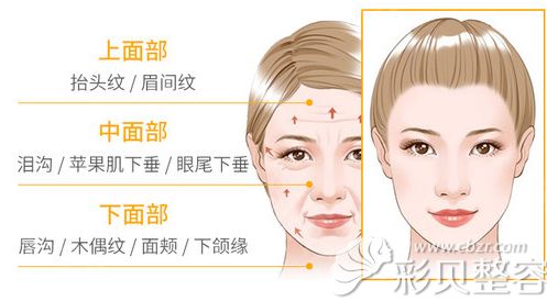 面部提升的作用