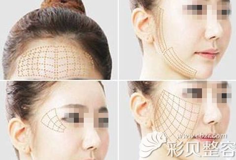 大v线面部标准布线图 大v线面部标准布线图