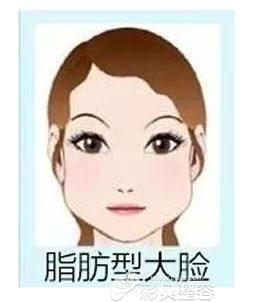 脂肪型大脸怎么办