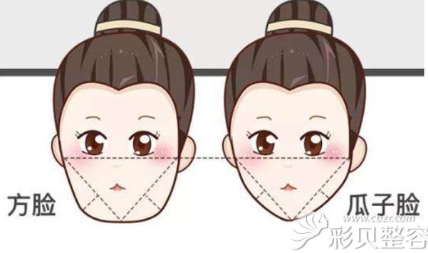 方脸如何变瓜子脸