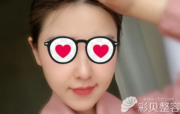 小拉皮提拉效果怎么样