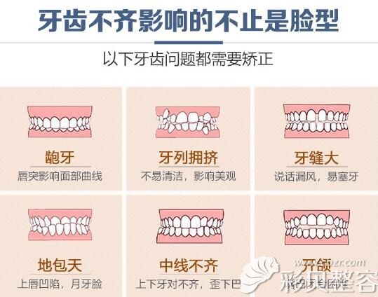 牙齿常见问题