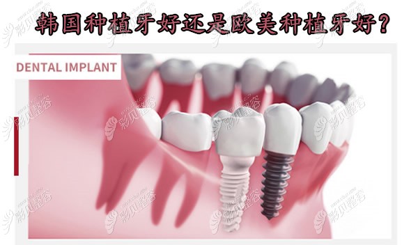 我26岁,门牙缺了两颗,种牙时为什么医生不建议做韩国种植牙?