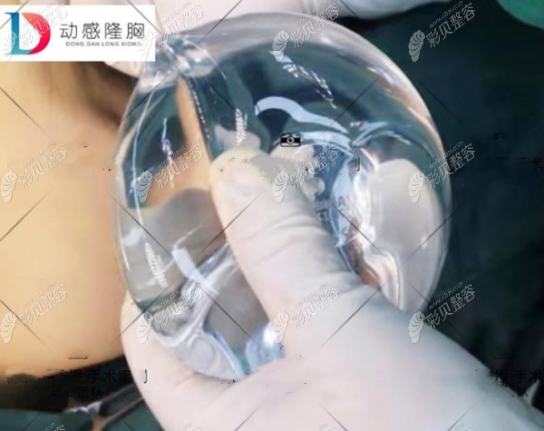 选它丰胸,应该不会出现网友说的"傲诺拉隆胸半年了