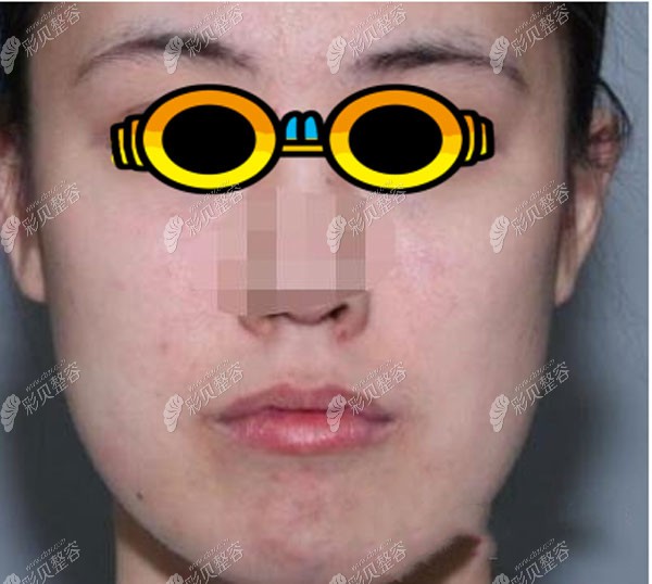 刚了解到"歪脸女孩小秋"事件,我惊呆了!沈阳杏林医院的朱石江医生竟然