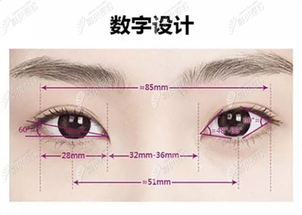 2,何黎医生拉眼睛的技术