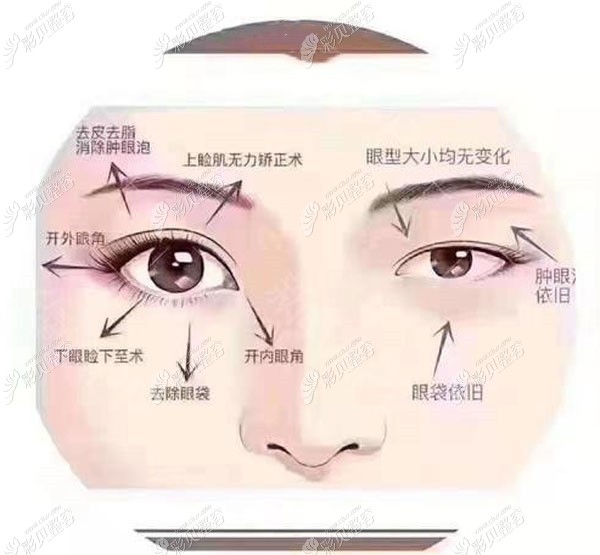 大眼综合包含项目