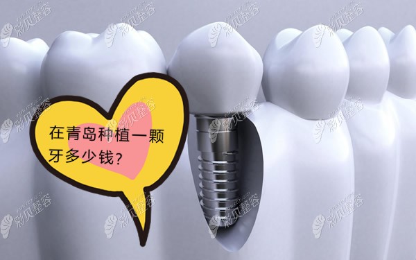 ​青岛牙博士口腔种植牙价格表，含all-on-4全口种植牙费用
