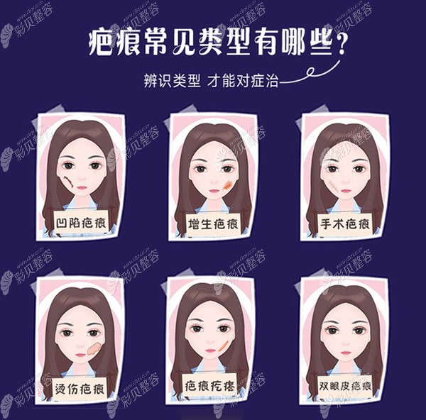 成都友谊医院去疤价格更新:看成都疤痕修复手术要多少