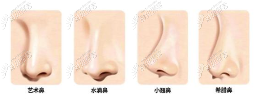 上海隆鼻口碑好的医生推荐:做鼻子风格自然,性价比还高