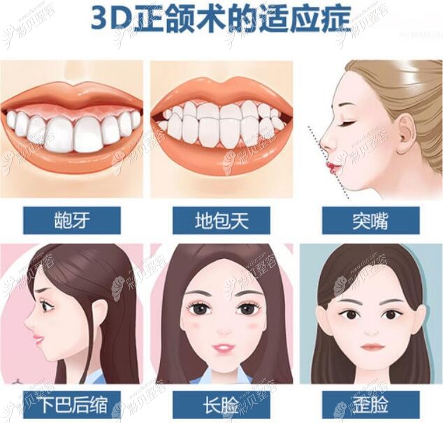 正颌手术方面有专研技术——3d正颌术,专门解决骨性龅牙,凸嘴,地包天