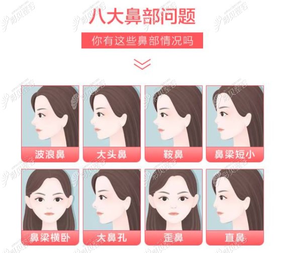 周口汇美整形价格表上新想做全切双眼皮鼻综合的约起来