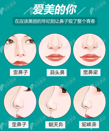 南宁爱思特王楷医生做鼻综合技术如何,顾客反馈他做鼻子好