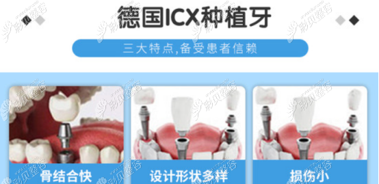 德国icx种植体价格是多少钱一颗和韩国登腾比哪个好些