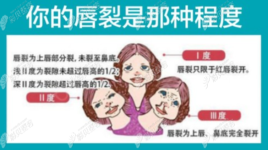 国内唇腭裂医生排行内的人虽不可以免费治疗但价格不高