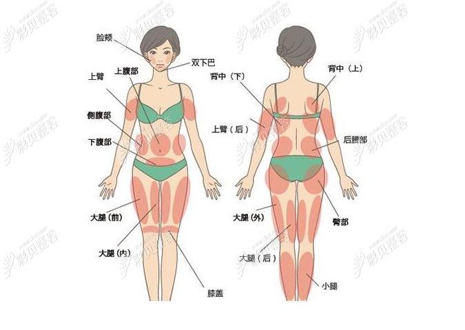 全身吸脂一次能瘦多少斤,抽脂一次不超过多少毫升?