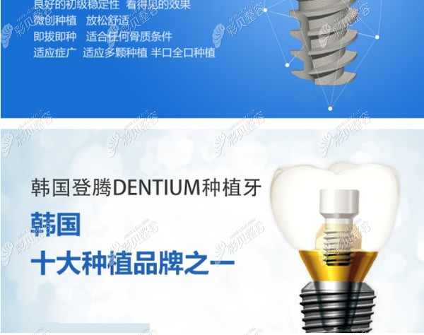 dentium登腾种植体,用的是4级纯钛材质.