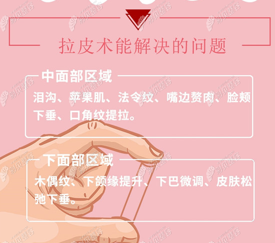 水波拉皮能维持多久,来听小姐姐的分享
