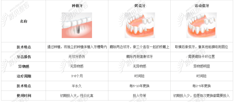 70岁老人全口假牙价目表带你了解老人装全口假牙多少钱