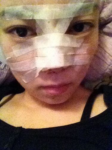 隆鼻详细过程分享 感受幸福的生活