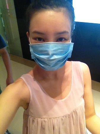 隆鼻详细过程分享 感受幸福的生活