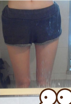 做了大腿吸脂+面部脂肪填充手术 立马小清新范儿了