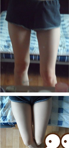 做了大腿吸脂+面部脂肪填充手术 立马小清新范儿了