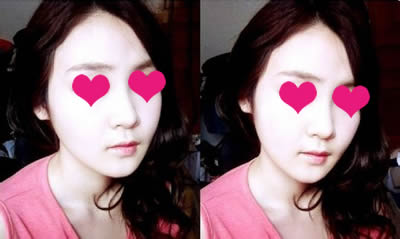 要是有人准备做整形手术的话一定要做好手术前准备工作，力保手术成功哦!