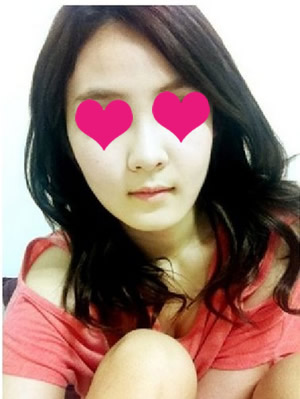 这大概是手术后一个月时拍的照片。面部还有些浮肿。不知道是不是我太认真太正经，拍的又是正面照片的原因，面部线条看起来不是非常的明显。
