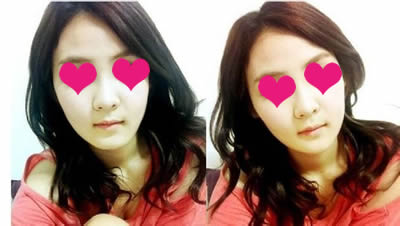 较近我每次拍照的时候，我都会想‘我为什么没有早点做手术呢?’要是我早点做了手术的话，那我早就是一位美女了。

