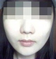 四周，接受管理后